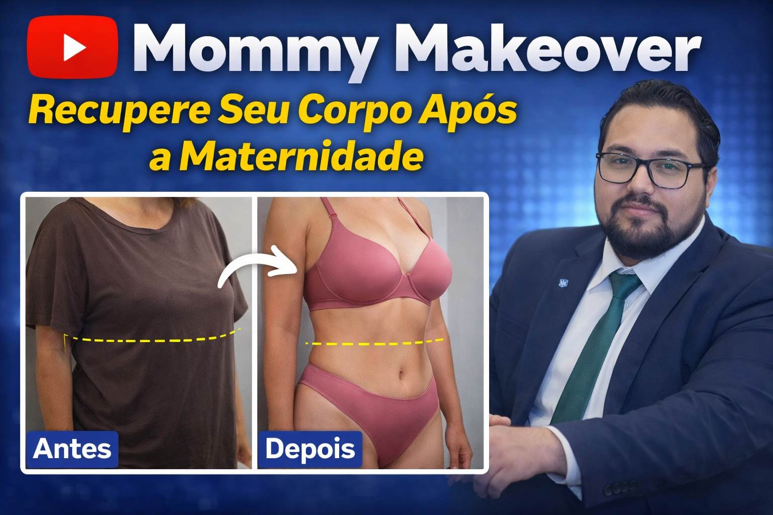 Mommy Makeover